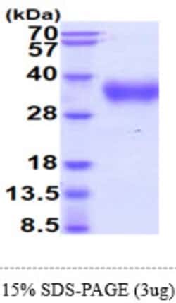 Novus Biologicals&trade;&nbsp;Recombinant Human IL-4 R alpha Protein